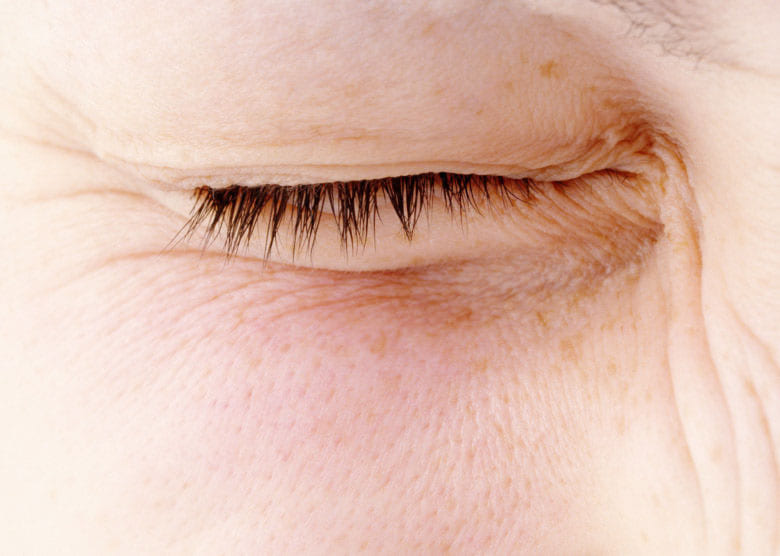 눈떨림 증상을 유발하는 마그네슘 부족 현상